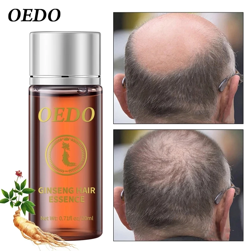 20ML Ginseng Hair Growth Essence Preventing Hair Loss Liquid Damage Hair Repair Treatment Dense Fast Restoration Hair Growth - view 6