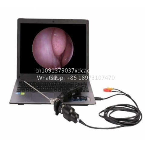 USB Port Video Otoscope . Portable Laptop Endoscope Camera For ENT