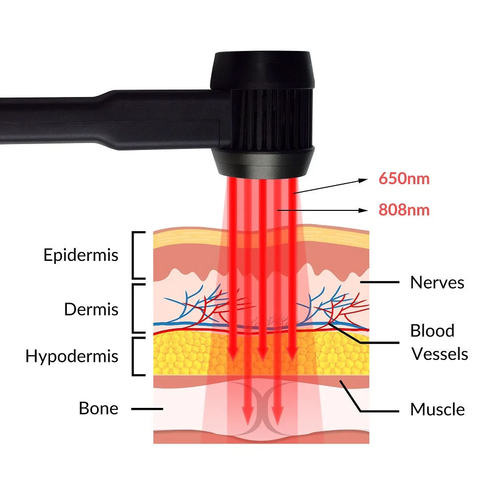 ZJZK Class Iv Cold Laser Therapy Infrared Physiotherapy Lamp 3W 808nm 650nm Chiropractic Use for Pain and Tendonitis Healing