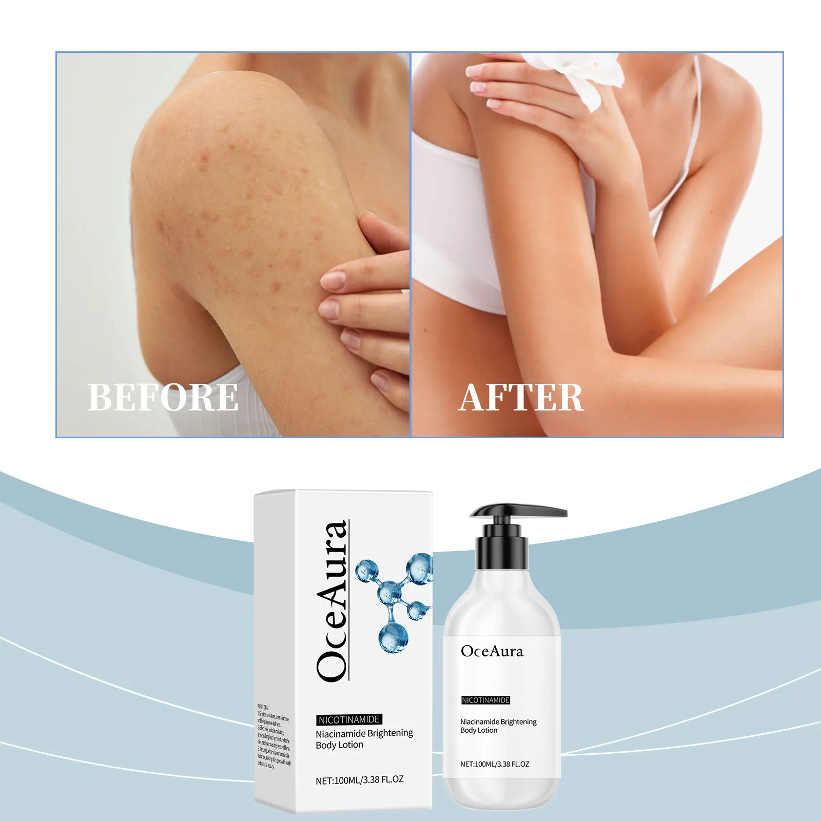 OceAura ナイアシンアミド ボディ ローション ジェントル ハイドレーティング ローション 保湿と鎮静作用のあるドライ ホーム ボディ ローション