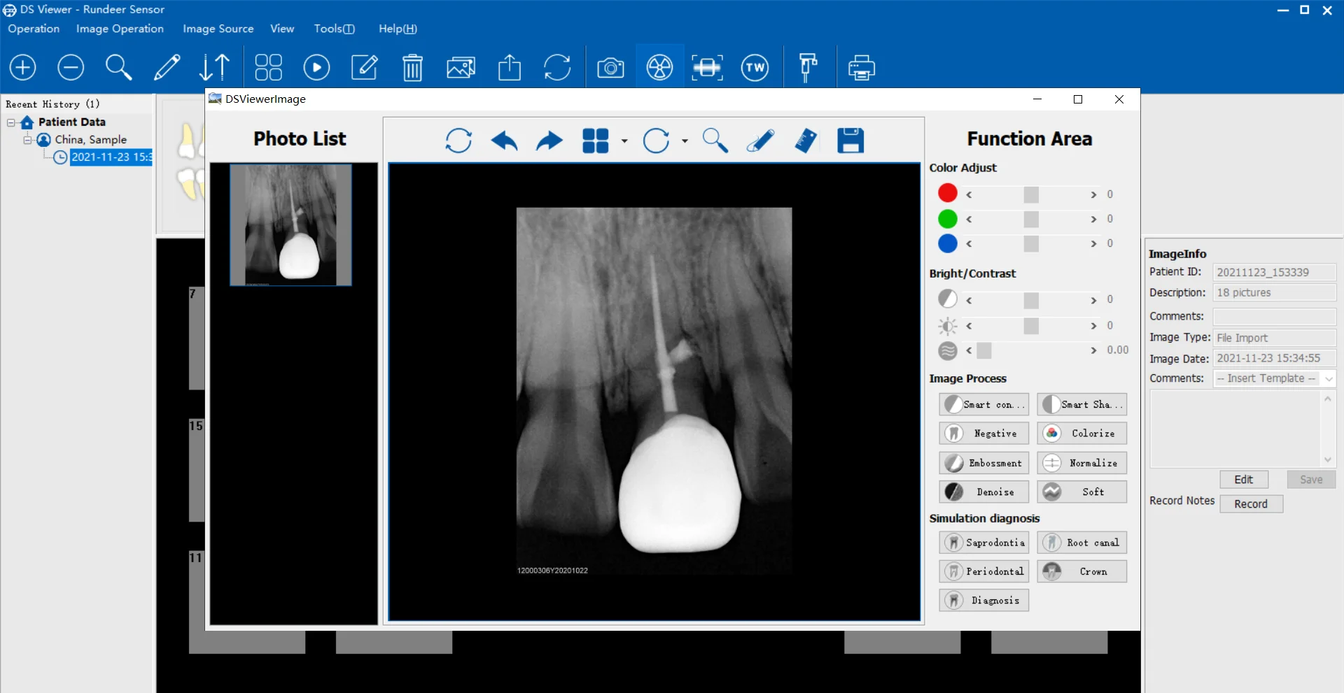 AG Dental X Ray Sensor 1Pcs Ultra-thin Fast Transmission Digital Sensor RVG IP68 Grade Cable Imaging System Dentist Equipment