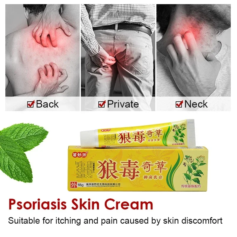 1 pcs 15g Traditional Psoriasis Dermatitis Eczema Eczema Ointment Itching Chinese Medicine Medicinal Skin Cream