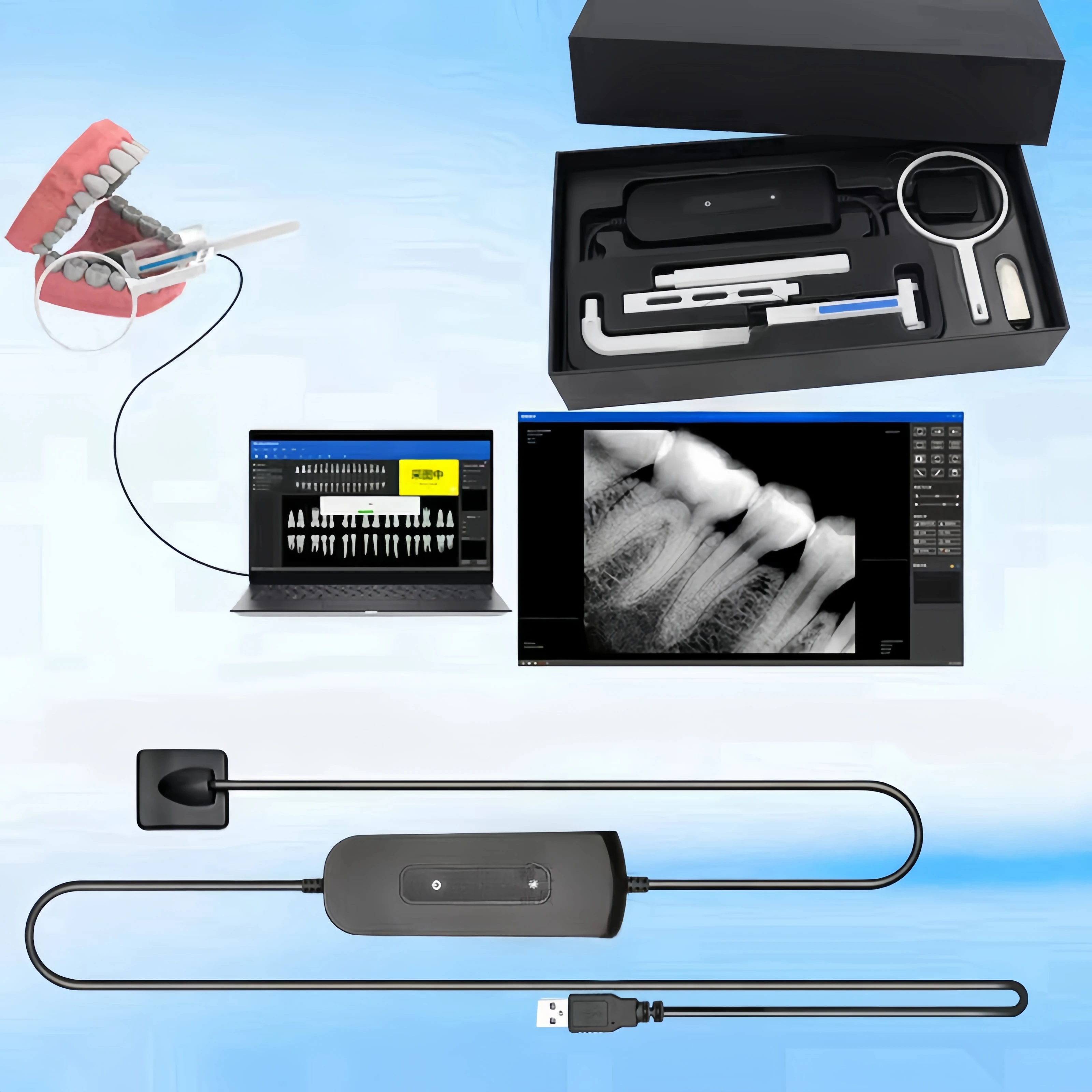 Dental Dentists Sensor X-Ray High-Frequency Rx Digital Intraoral Digital System H D Image Radiovisografo Dentistry Implant Tools