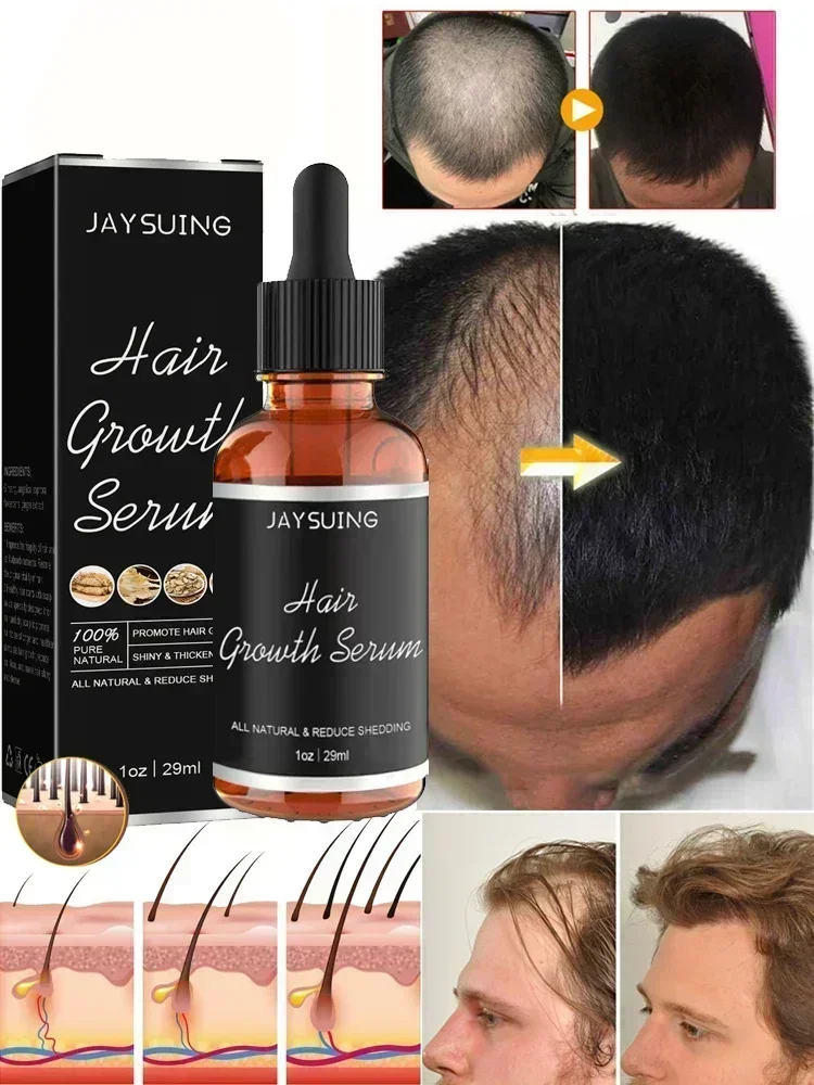 Hair Growth Products Biotin Anti Hairs Loss Oil Scalp Treatment Fast Growing Hair Care Essential Oils for Men Women Hair Care