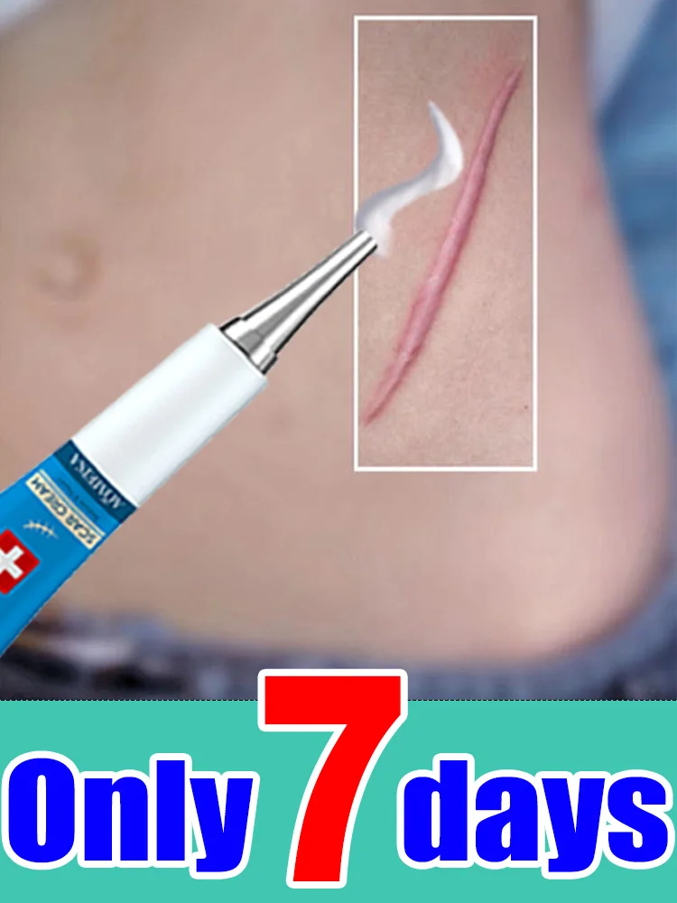 2025年売れ筋ダメージケアツール