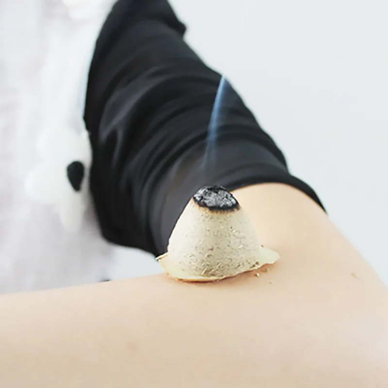 Conicalness Moxa Stick Abdomen Moxibustion Chinese Herbal Medicine Combustion Therapy Body Acupuncture Meridian Warm Massage