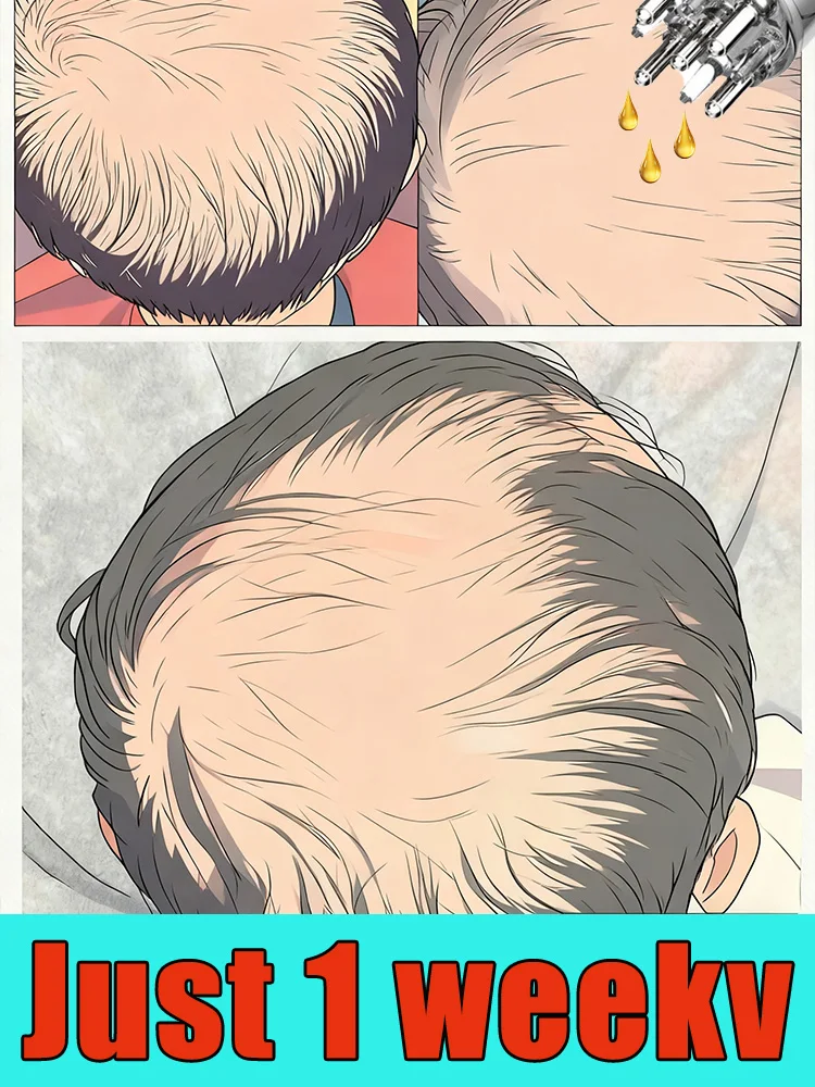 

2025 NEW UPGRADE Scalp Applicator Liquid Comb for Hair Scalp Treatment,Liquid Guiding Massager, Hair Growth Serum Oil Apply.