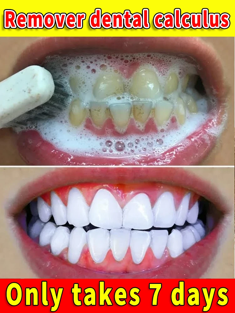 Rapidly dissolves dental plaque and whitens teeth