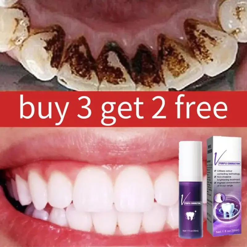 

New 30ml V34 Tooth Cleansing Mousse Purple Bottled Press Toothpaste Refreshes Breath Remove Stains Reduce Yellowing Oral Care ﻿