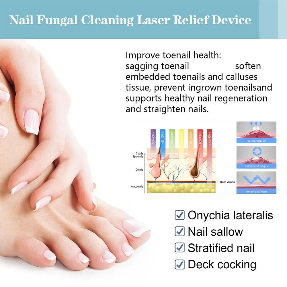 جهاز ليزر الأظافر فطريات الأظافر آلة العلاج بالليزر الليزر مع إصلاح أظافر علاج أظافر فطار الفطر G7C9