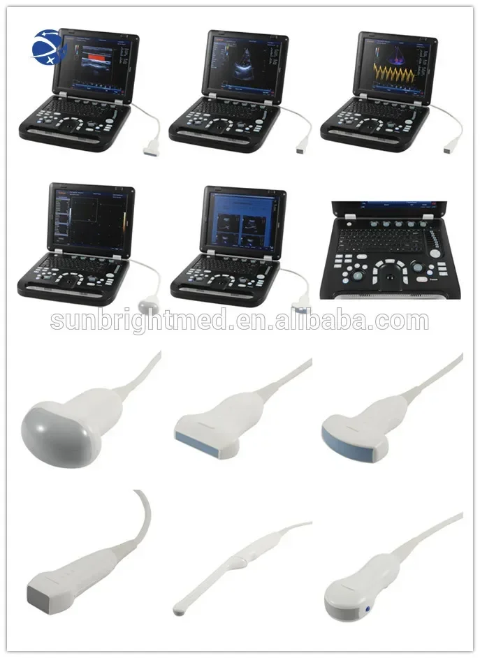 Best price  laptop ultrasound machine/Hand-carried Portable 3D 4D Color Ultrasound Doppler for hospital