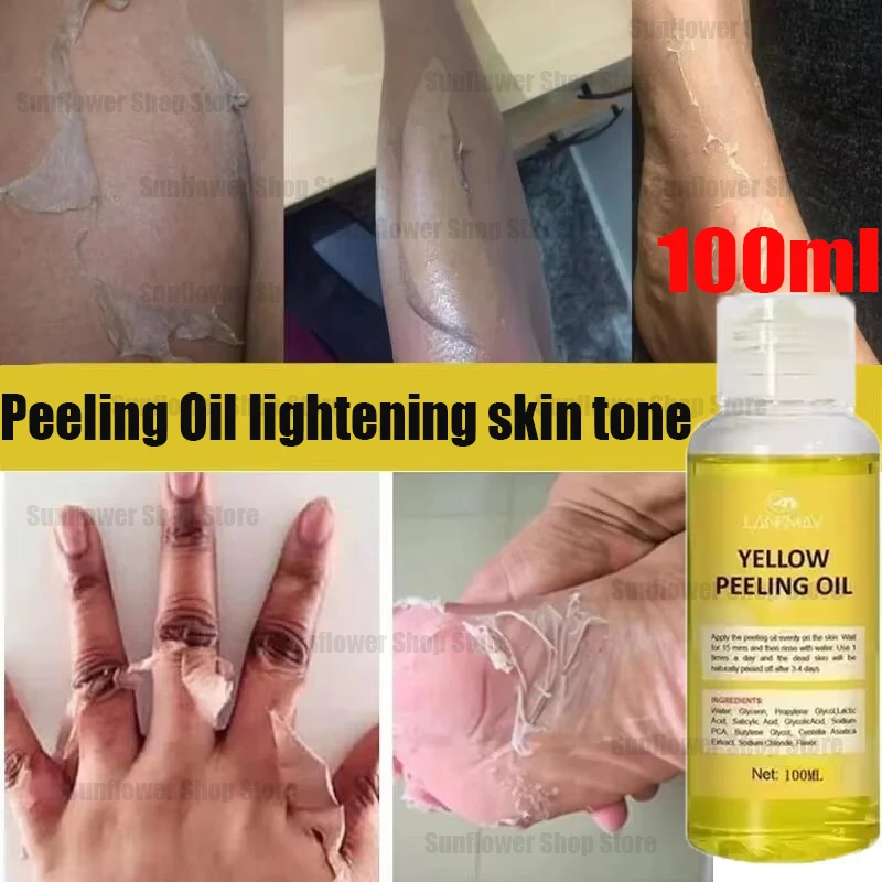 

Body Care Exfoliating Yellow Peeling Oil 100% Organic Bleaching Dark Skin Serum Dark Knuckles Fast Whitening Korean Cosmetics