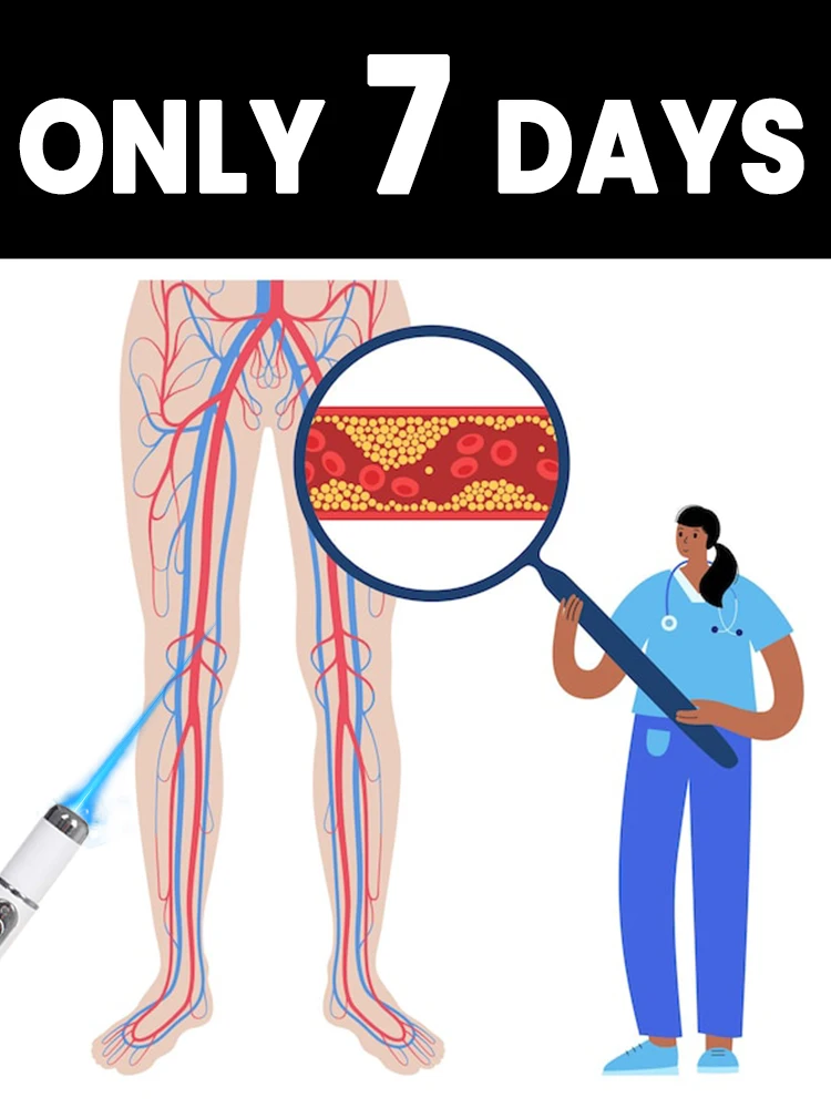 

Leg vein laser pen: Quickly reduce spider veins. Suitable for tired and heavy legs. Can be used daily