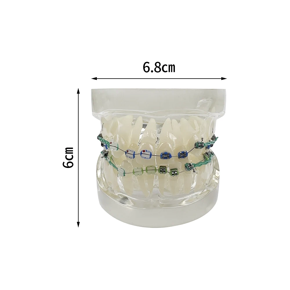 Dental Typodont modello di denti ortodontici con staffe in metallo e ceramica bretelle fascette a catena modelli di trattamento odontoiatrico con filo ad arco