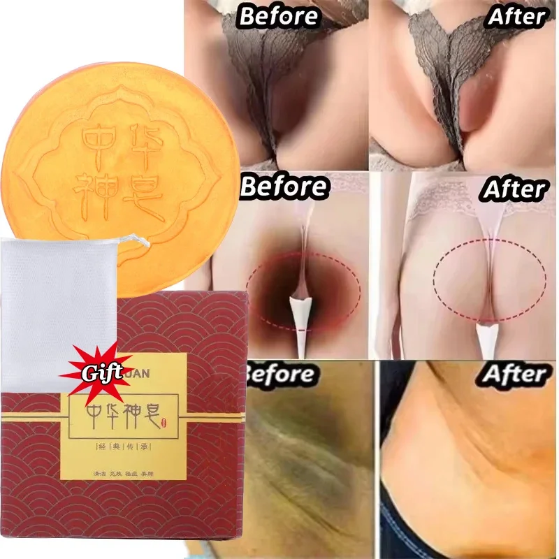 

Body Whitening Soap Deep Cleaning Armpit Leg Knees Underarm Bleaching Chicken Skin Removal Soap Brighten Smooth Fair Skin Care