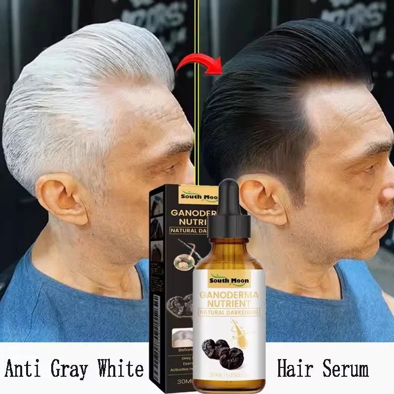 

Anti Gray White Hair Serum Liquid White To Black Natural Color Repair Nourish Scalp Products Anti Loss Hairs Care For Men Women