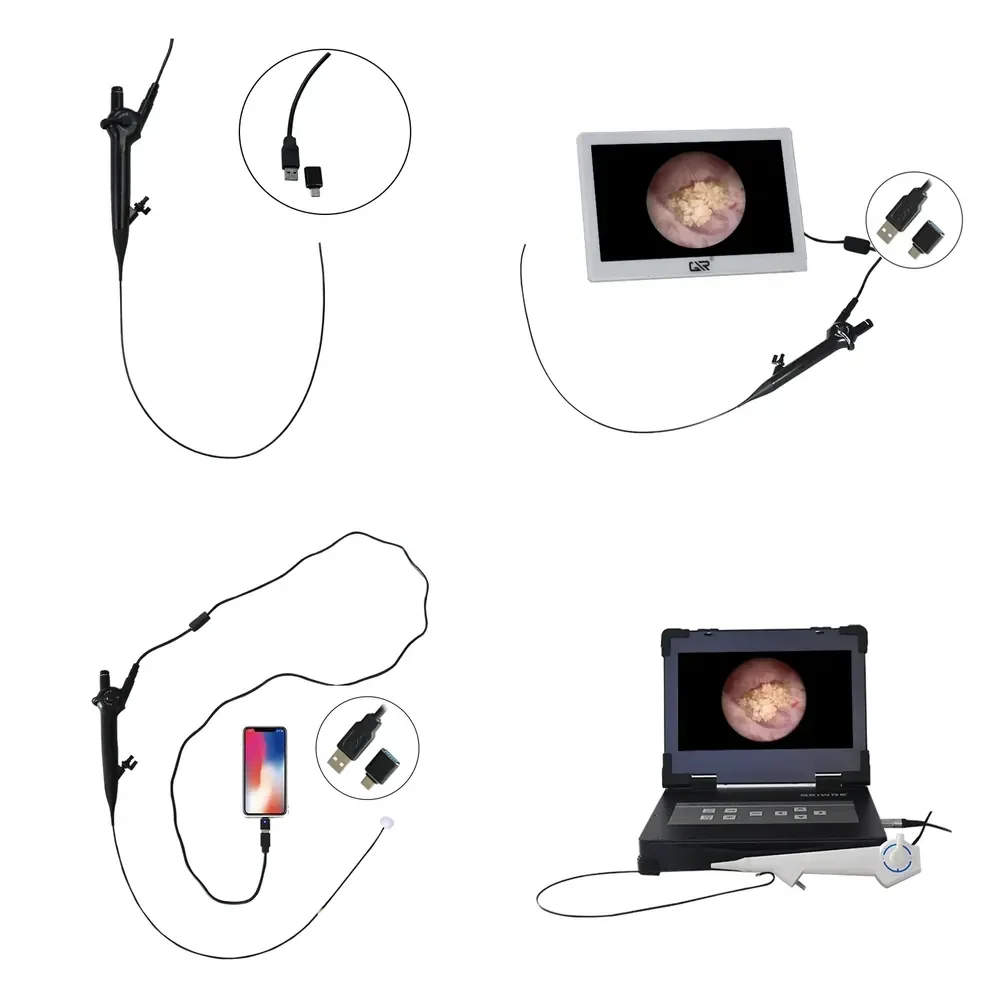 

Factory Explosion Reusable Ureteroscope with USB Pad Type-C Flexible Ureteroscope for Medical Surgery