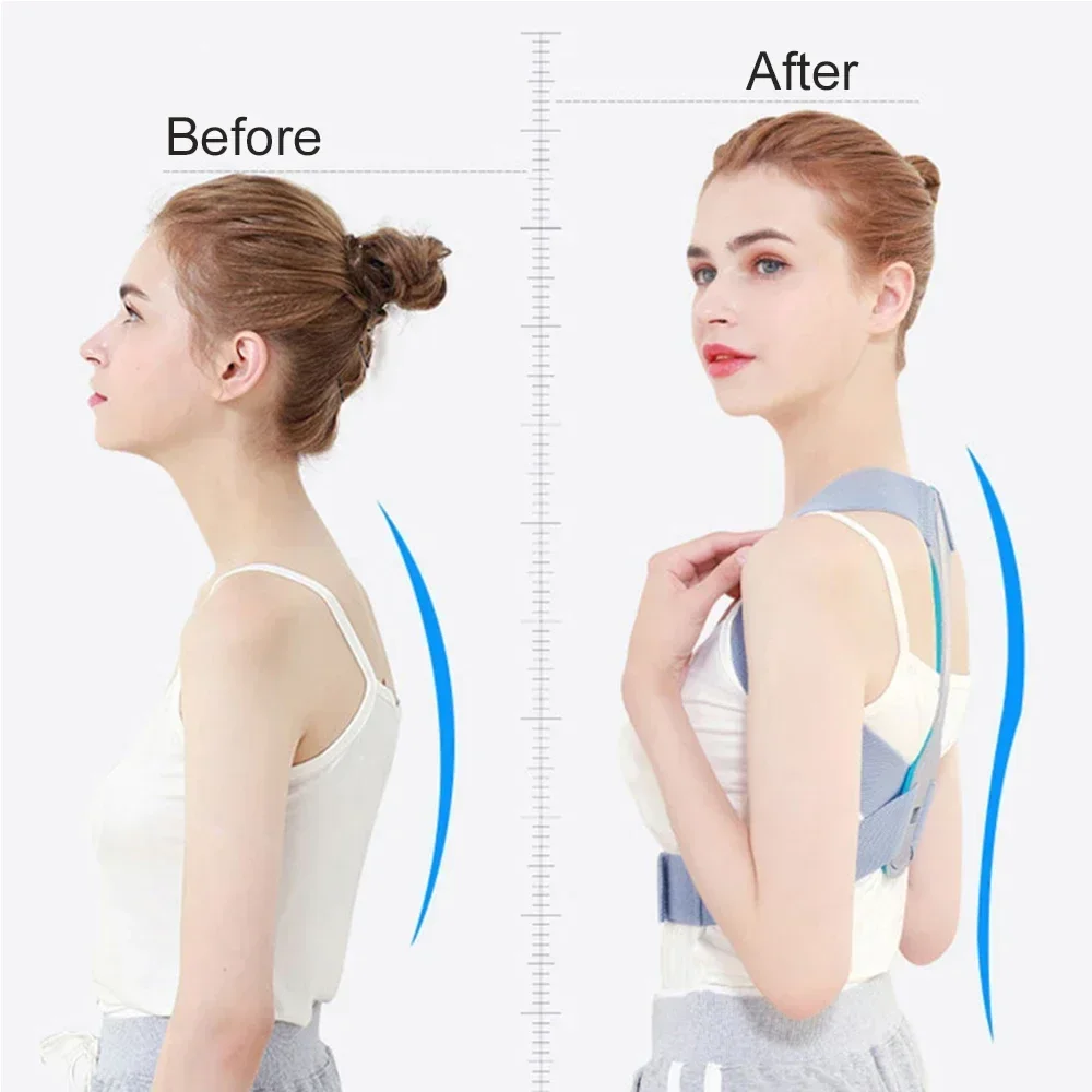 Adjustable Posture Corrector Brace Shoulder Back Support Belt for Men Women Upper Back Providing Pain Relief Medical Health Care