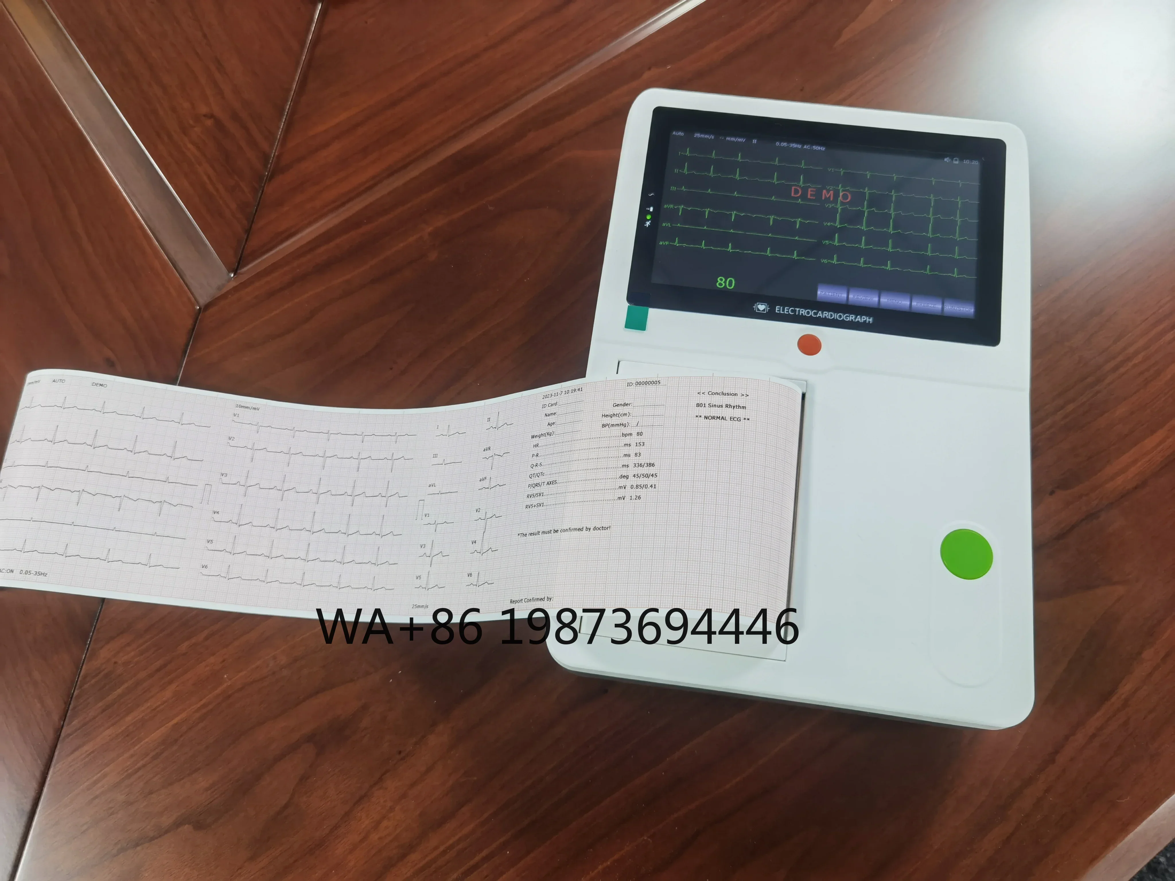

Animal Medical Equipment VET Machine color Veterinary Electrocardiograph