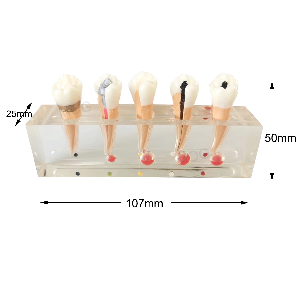 Dental Teeth Model Endodontic Treatment Model Demonstrates 5Stages of Root Canal Procedure on 2nd Premolar for Dental Technician