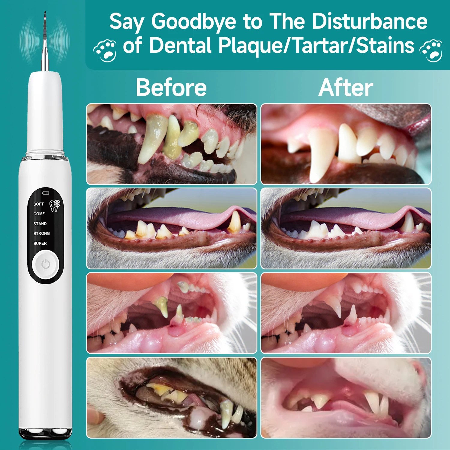Thumbnail 4 - #2 Compare Ultrasonic Dental Scalers Before You Buy