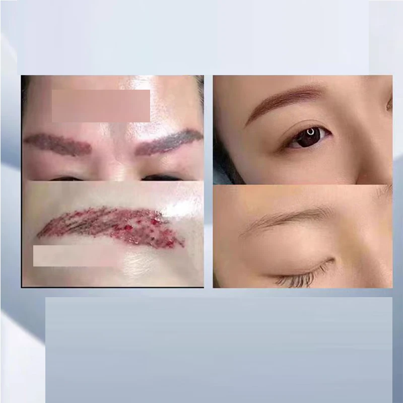 อุปกรณ์ความงามแบบพกพา