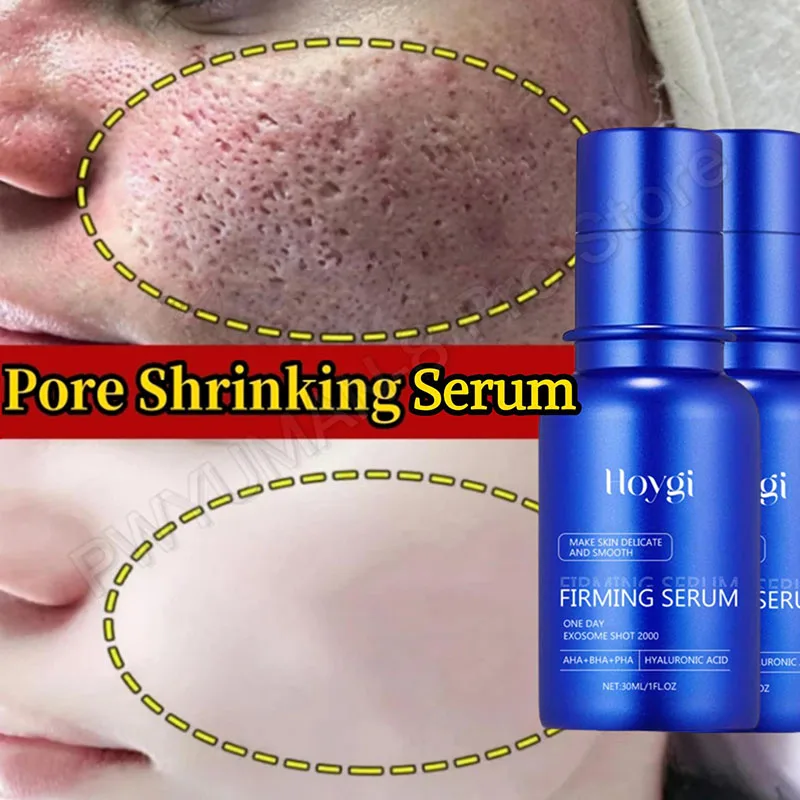 

Blue Microneedle Shrink Pores Facial Essence Whitening Lifting Firm Fine Line Serum Moisturise Melanin Remove Skin Care Product