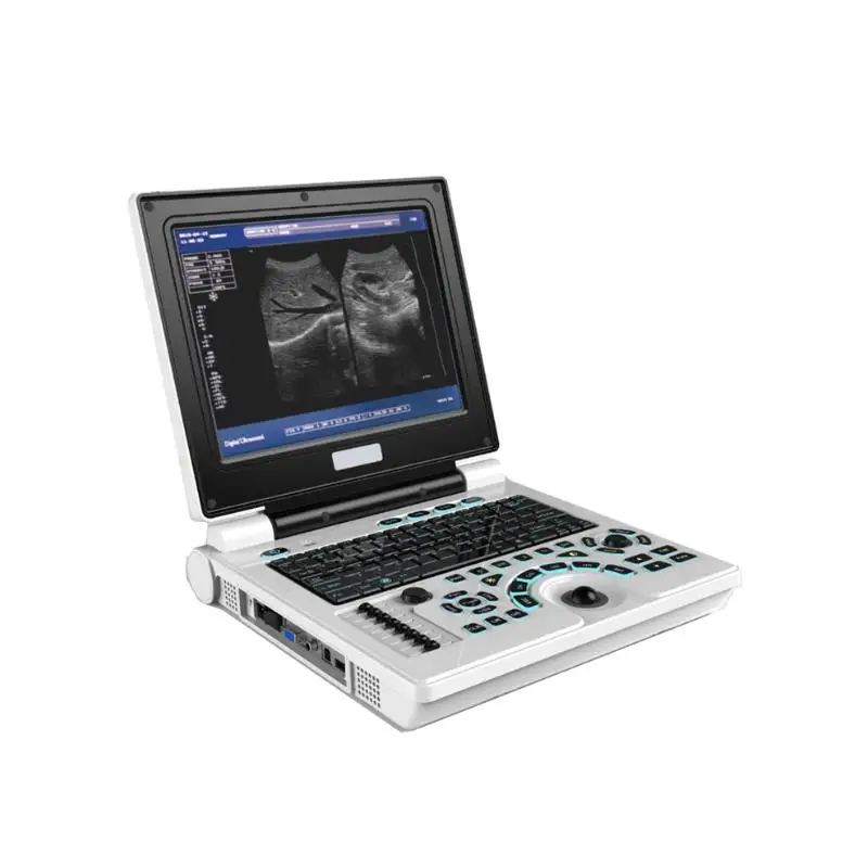 MY-A008D Digital Ultrasound Scanner portable ultrasound machine laptop ultrasound machine for One-stop medical supplier