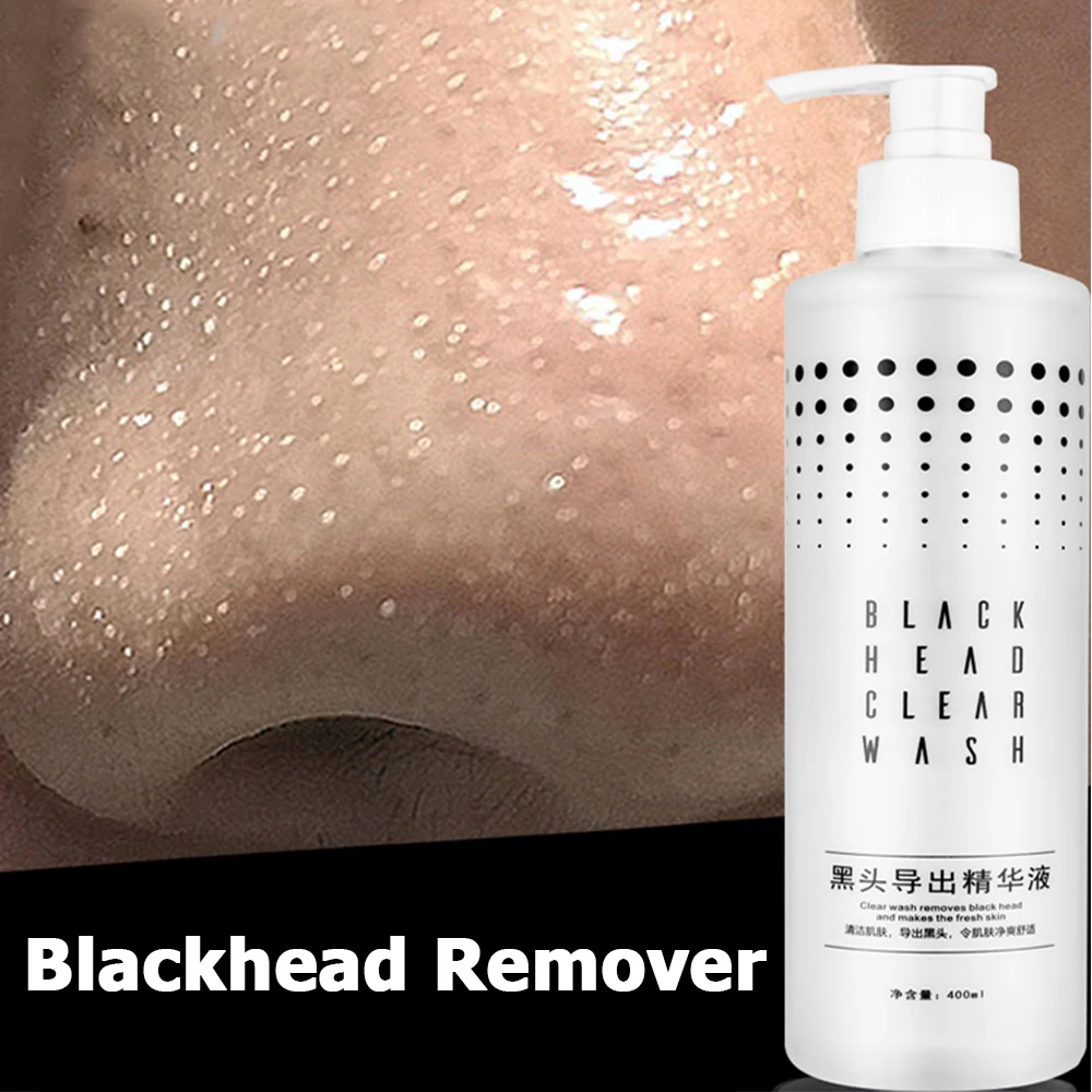 White Head Black Spots Cleaner Conductive Fluid For Facial Deep Cleansing Blackhead Pimple Remover Skin Point Noirs Extractor