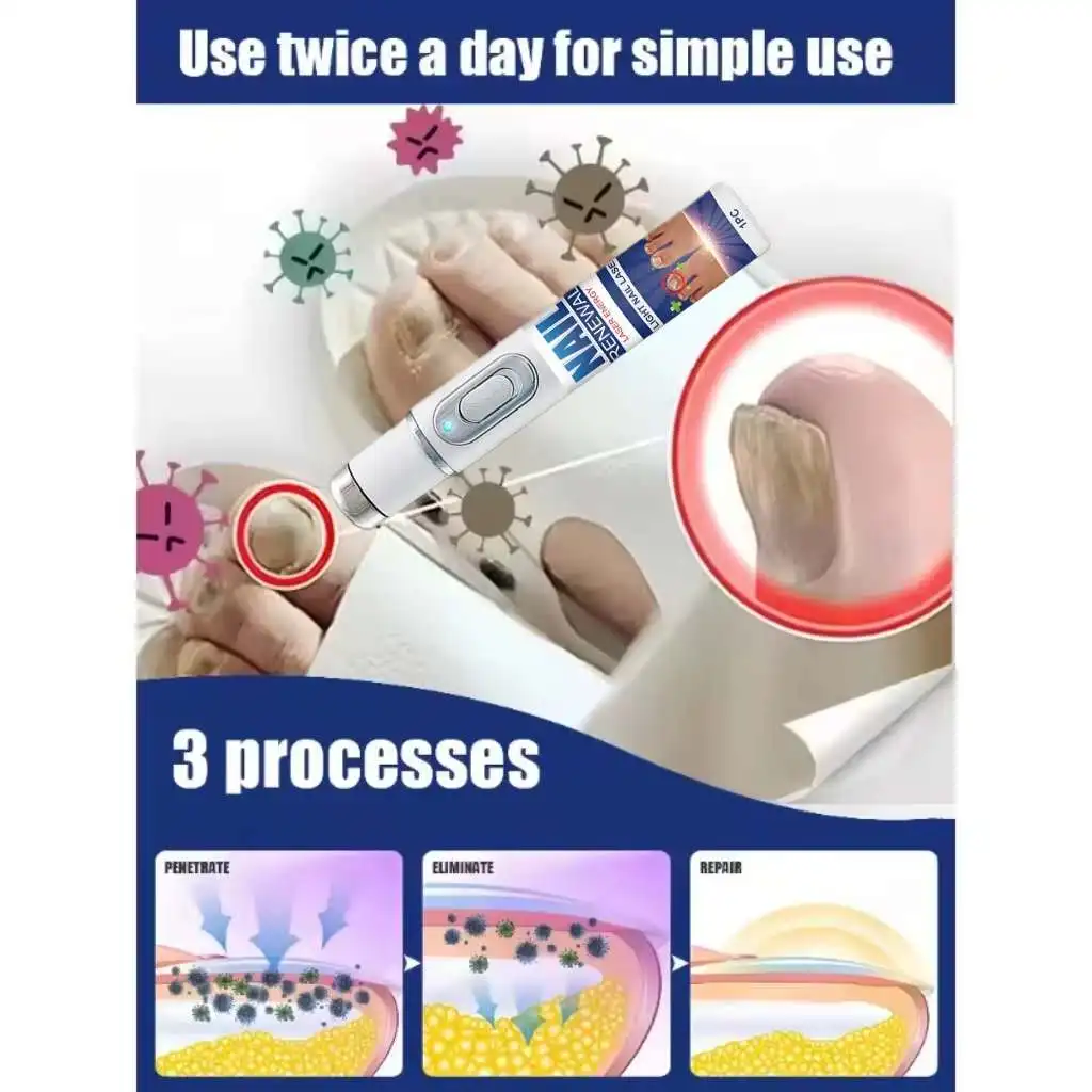 تقنية مضادة للعفن ومضادة للبكتيريا، تستعيد الأظافر إلى لمعانها الطبيعي