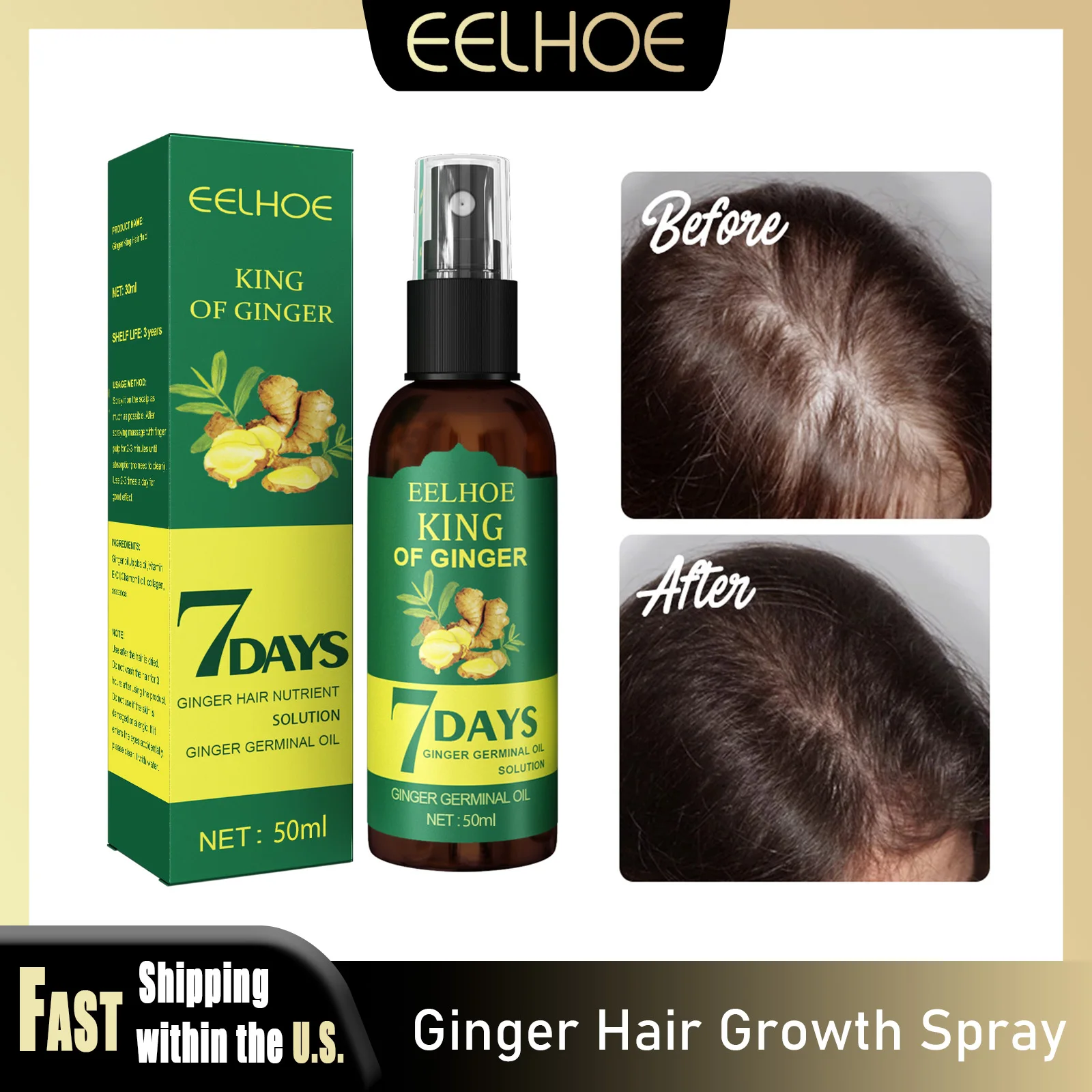 

EELHOE имбирный спрей для роста волос, натуральные ингредиенты, питание, увеличение волос, восстановление кожи головы, контроль жирности, нежный уход для женщин и мужчин