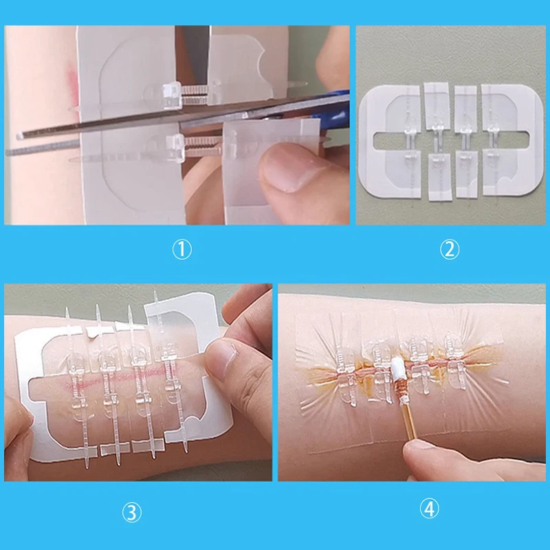 1/2/10Pcs Zipper Tie Wound Closure Patch Hemostatic Patch Wound Fast Suture Zipper Band-Aid Outdoor Portable Skin Care