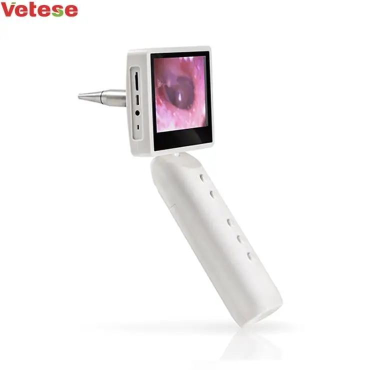 

Nantong Yikun cheap digital otoscope price