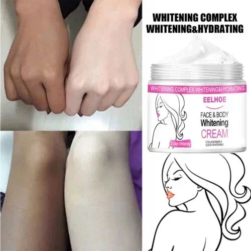 

Effective Improve Body Whitening Cream Armpit Legs Knee Elbow Bleaching Cream Dull Remove Dark Spots Melanin Brighten Skin Care