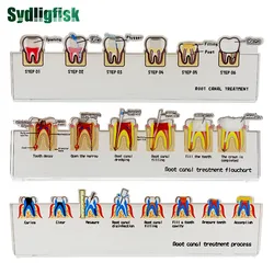 Dental Root Canal Treatment Flowchart Stand Endodontic Process Guide Dental Lab Study Teaching Demonstration Model Dentist Gift