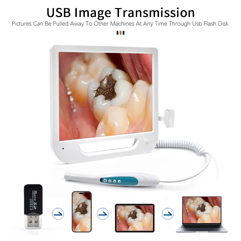 Dental Endoscope 17inch LCD Monitor VGA HDMI Intra Oral Camera 6LED Digital Dentistry Intra Oral Camera 8 Million Pixels