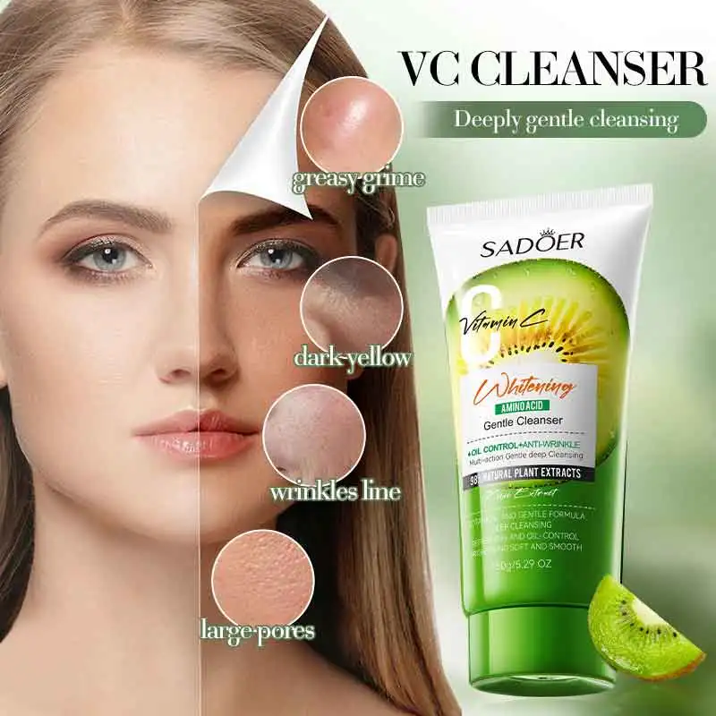 Fruit Kiwi VC Whitening Anti-Wrinkle Amino Acid Gentle Cleanser for Oily Skin, Soothing, Purifying and Cleansing