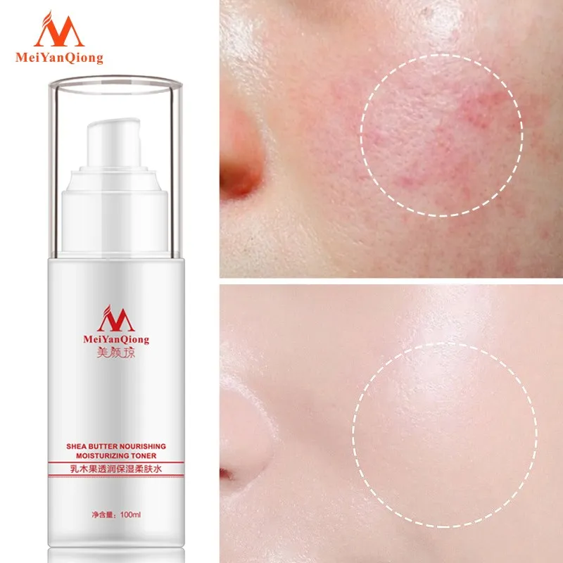 

Shea Butter Collagen Hyaluronic Acid Extract Moisturizing Face Toners Skin Care Moisturizing Whitening Acne Treatment Face Care
