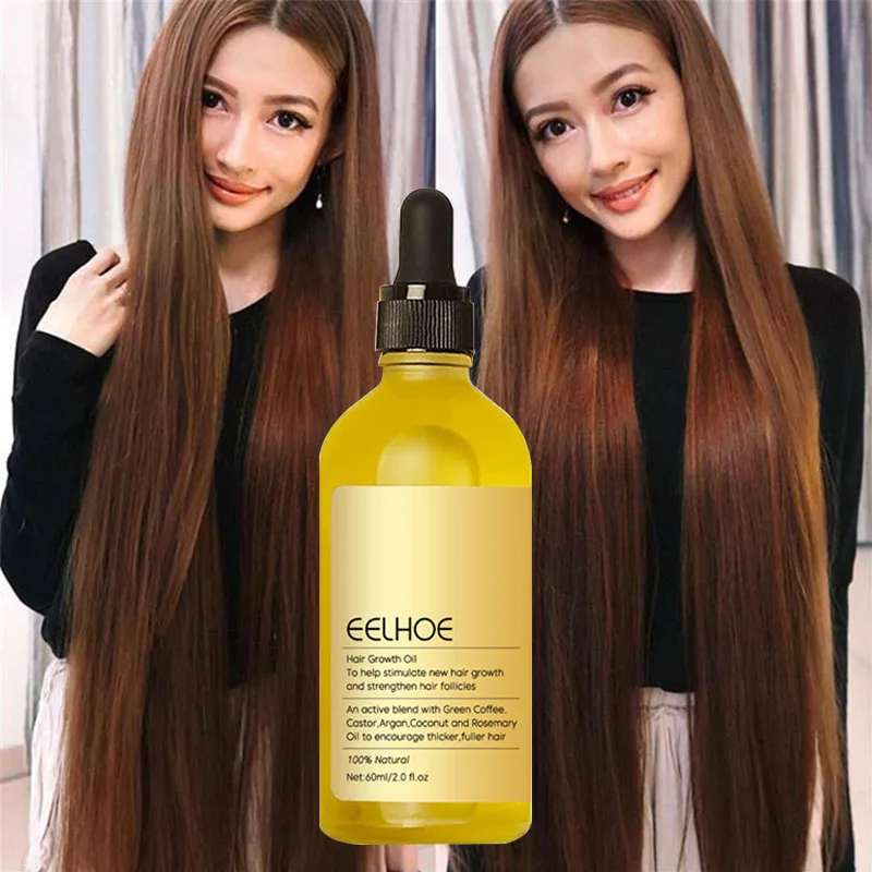 Productos para el crecimiento del cabello, aceite esencial para prevenir la caída del cabello, tratamiento antisecado para el cuero cabelludo de crecimiento rápido, reparación de belleza y salud para hombres y mujeres