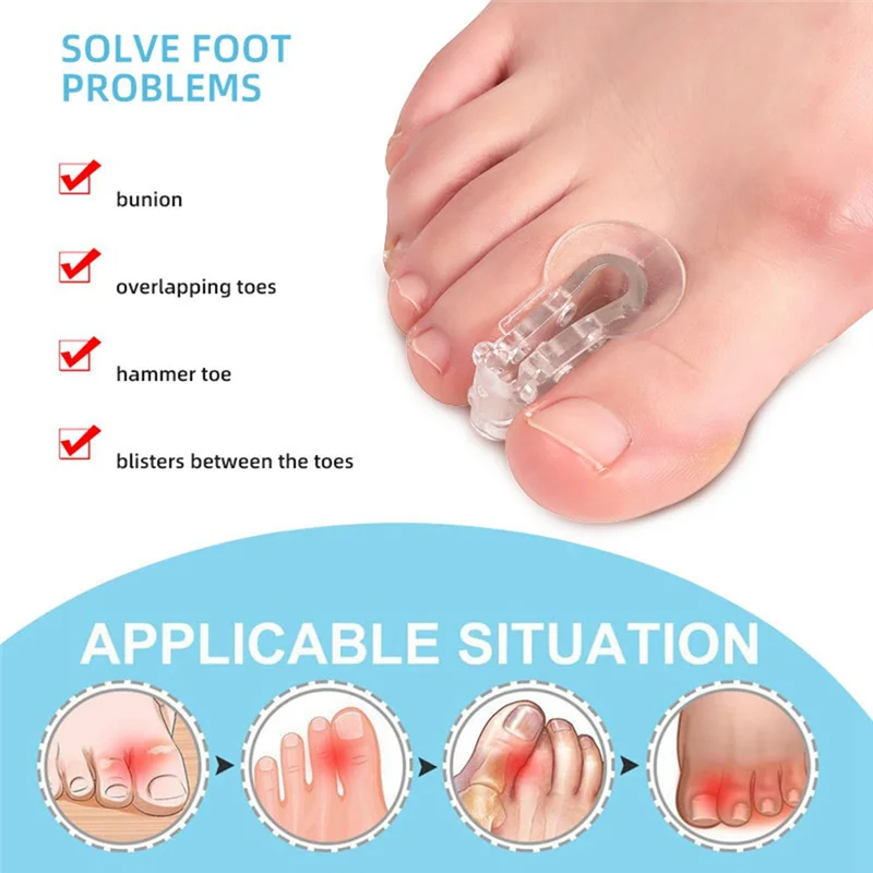 LITE-10er-Pack Zehenabstandshalter, Separatoren, Bunion Corrector Gel Orthesen für Bunion, überlappende Zehen, Hallux Valgus 3,5 x 2 cm