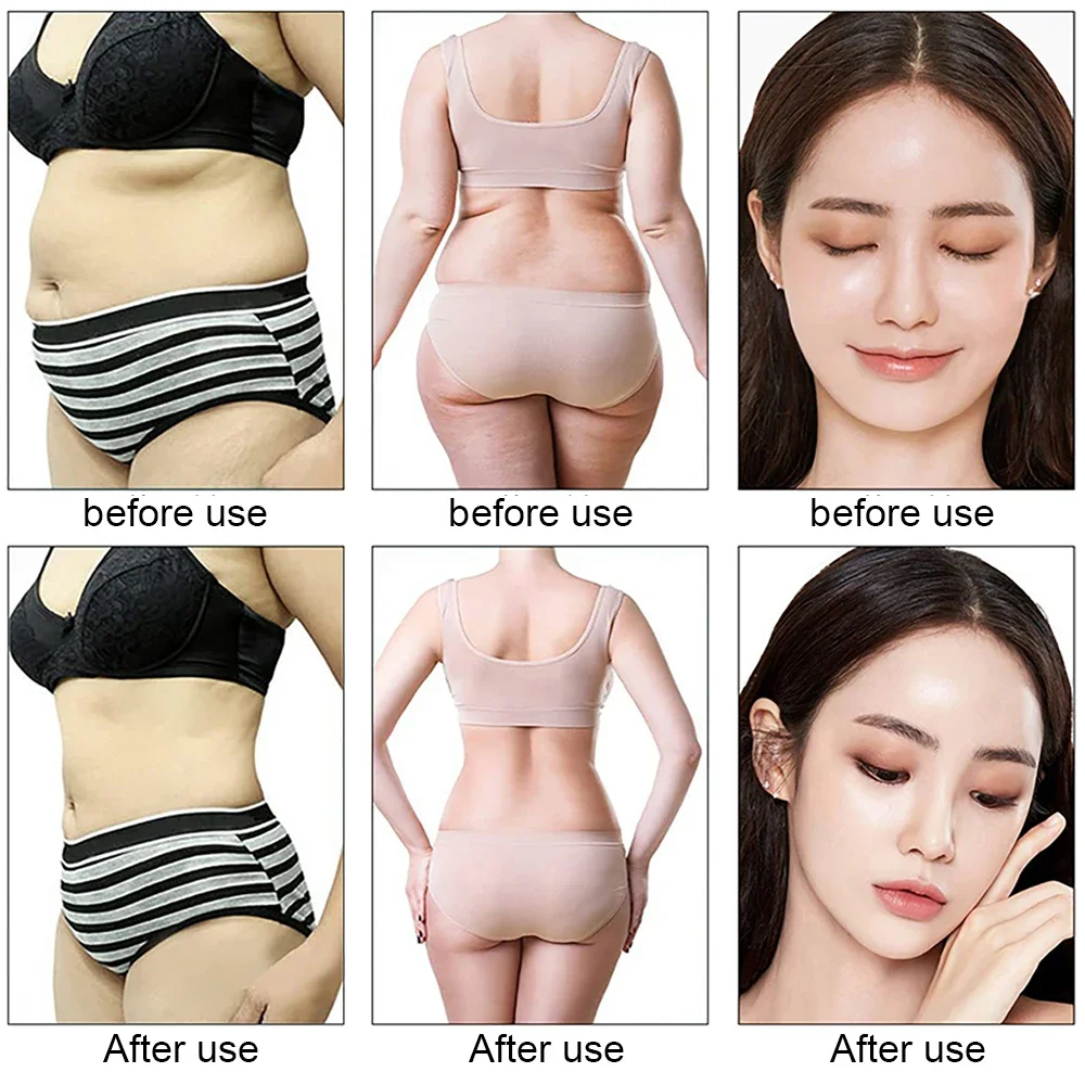 9 In 1 Ultrasonic Cavitation Fat Burning Machine RF Body Slimming Device  EMS LED Photon Skin Rejuvenation Lifting For Beauty