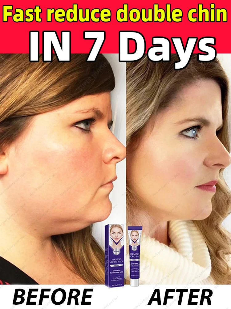 The product that 98% of people will repurchase to get rid of chubby cheeks