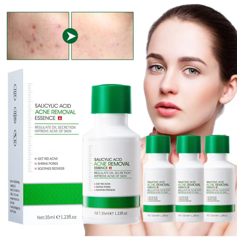 Suero Facial con Ácido Salicílico, Control de Grasa, Minimizador de Poros, Suero Suavizante, Esencia de Ampolla con Células Madre que Aumenta la Luminosidad, Cuidado de la Piel Coreano