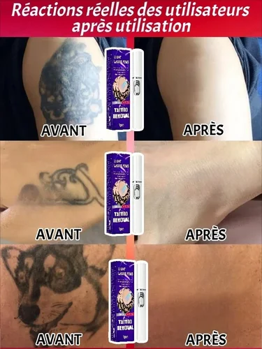 Imagen 2 del producto soopusoooqsoodsooo os