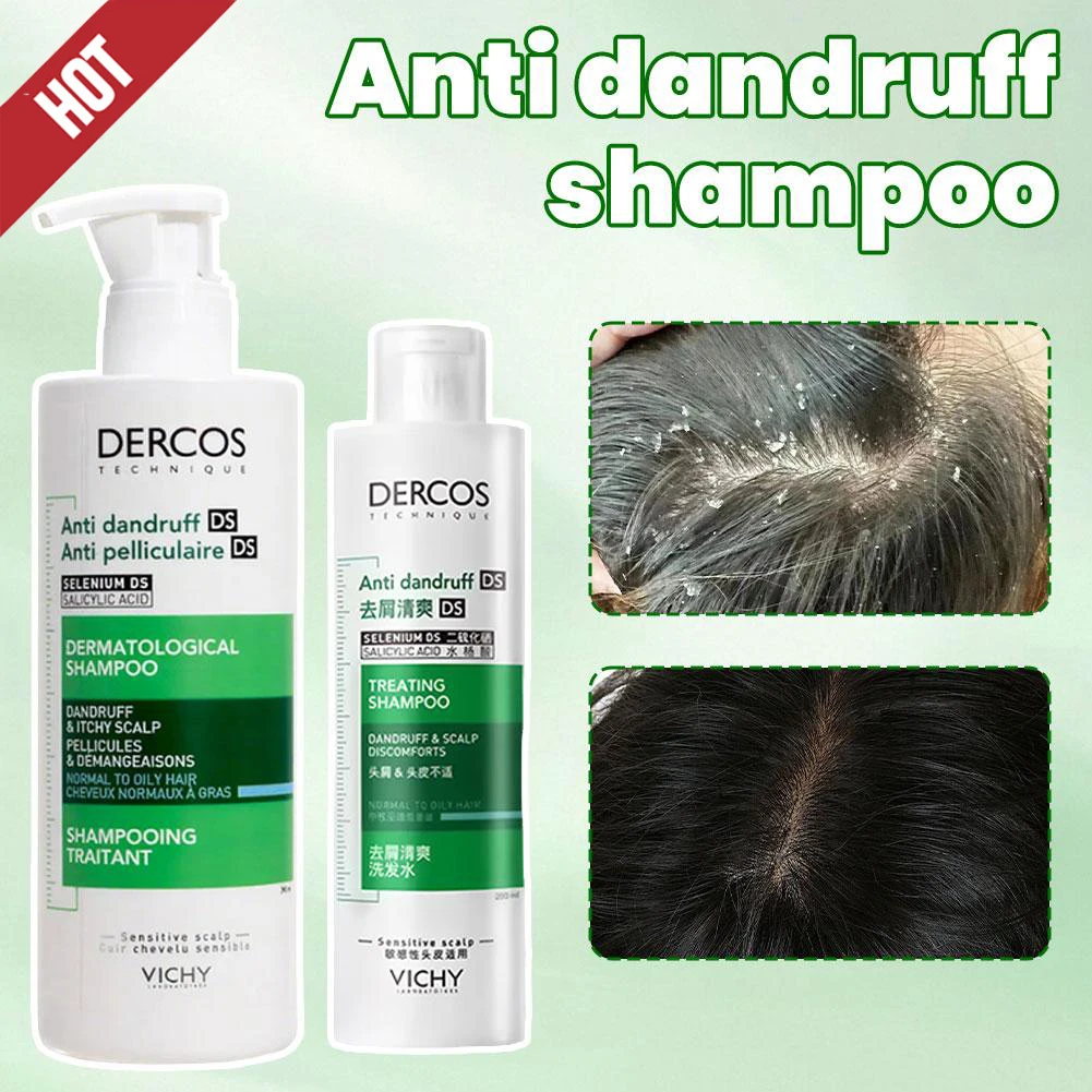 

VICHY DERCOS против перхоти, жирный шампунь для кожи головы для чувствительной кожи головы, стойкий контроль жирности, освежающий успокаивающий шампунь для ухода за кожей головы