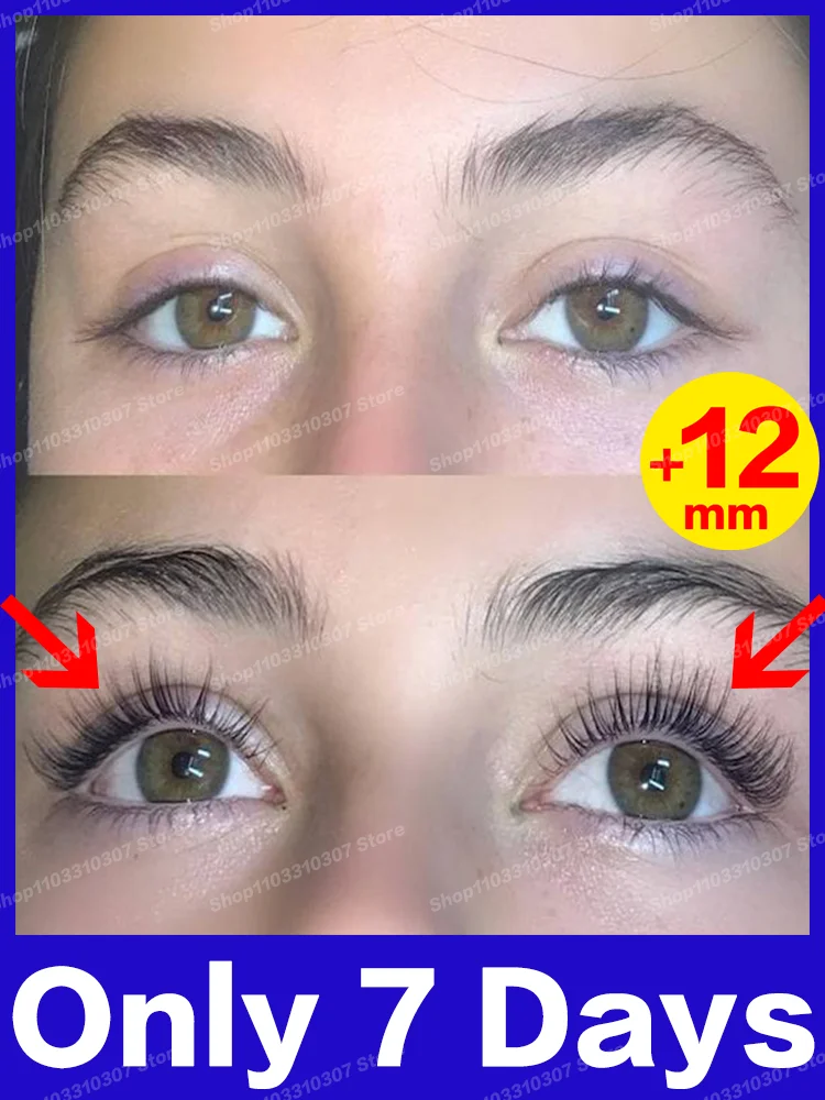 

Eyelash Growth Fast Lengthening Thicker Lashes Lifting