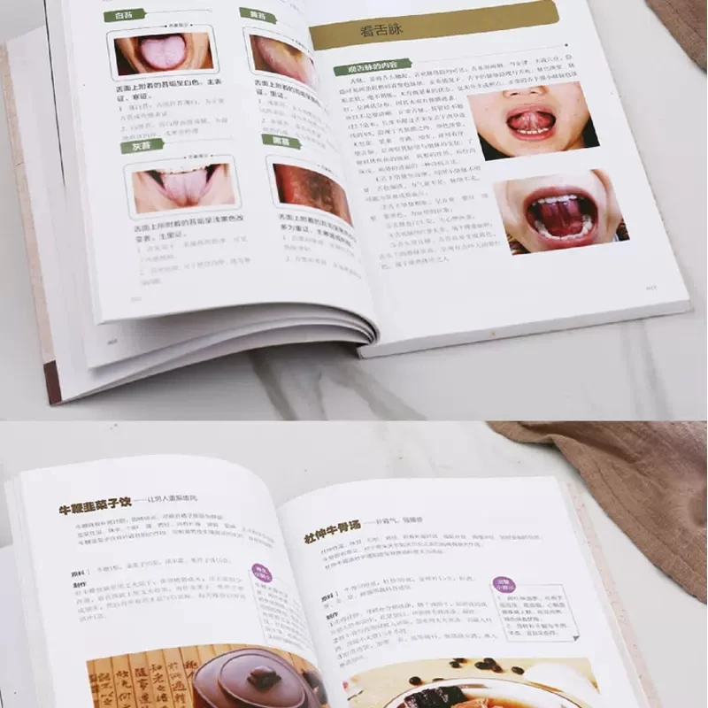 Tongue Diagnosis Manual: Viewing Tongue to Know Health Book on Health Preservation of Traditional Chinese Medicine in Zero Basic