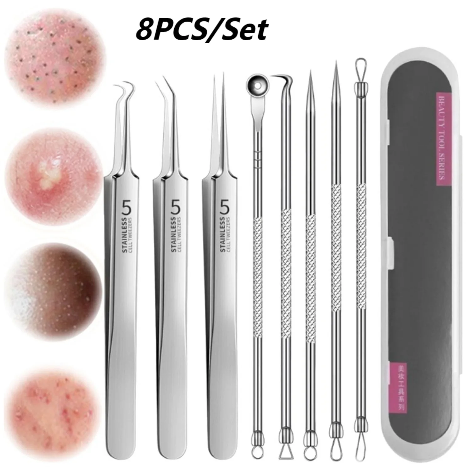 1/3/6/8 pçs de aço inoxidável acne clipe removedor cravo pinça extrator espinhas acne agulha facial salão beleza ferramentas cuidados com a pele