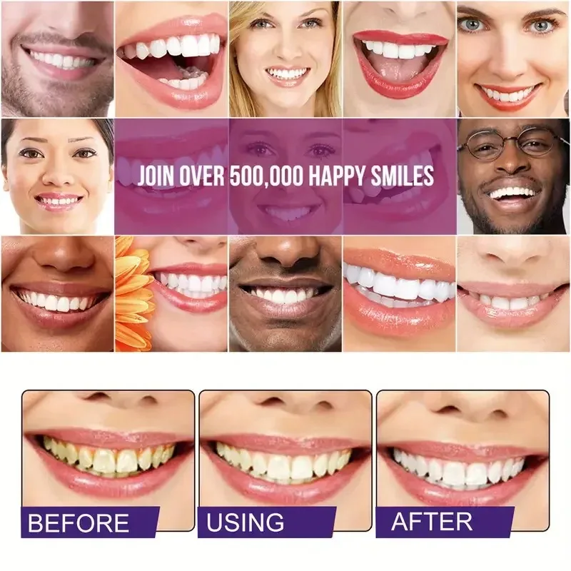 1 x rotierender Zahnreinigungsstift, tragbar, zum Entfernen gelber Flecken, erfrischender Atem, Lächeln, Mundreinigung und Hygienepflege