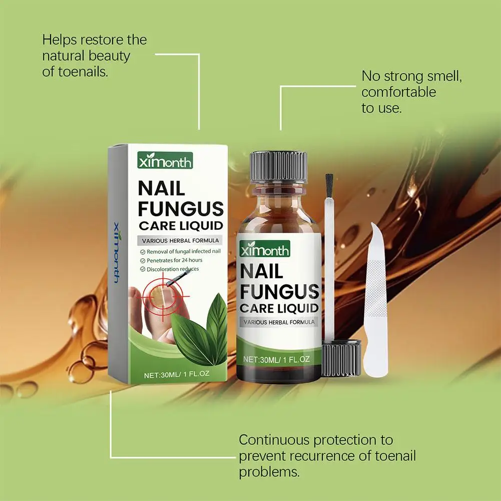 Onychomycosis Hand Foot Removal Repair Care Nail Fungal Paronychia 50g Treatment Fungus Anti Infection Serum Toe S6G3